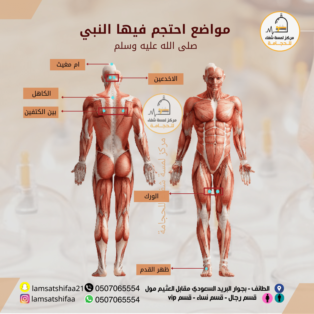 مركز لمسة شفاء للحجامة - الطائف حي جبرة - معتمد من الطب البديل - خصوصية تامة