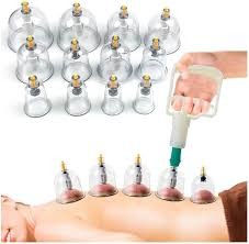 مركز حجامة متميز في الطائف