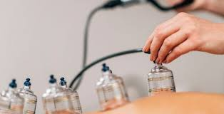 حجامة علاجية وفق السنة الطائف