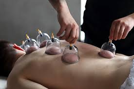 حجامة للصداع الطائف