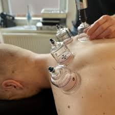 أسعار الحجامة في الطائف