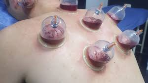 حجامة معقمة الطائف