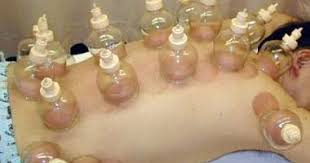 حجامة للكسل والخمول الطائف