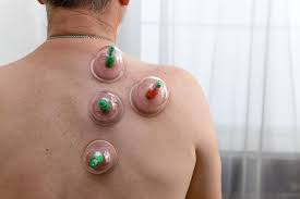 image 52 حجامة للظهر كامل الطائف