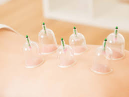 حجامة في الطائف اليوم