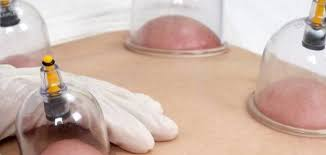 مركز حجامة حديث بالطائف