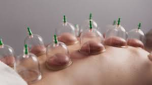 image 58 حجامة لتخفيف الألم الطائف