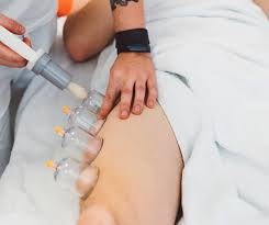 حجامة موصى بها الطائف