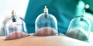 مركز حجامة مرخص الطائف