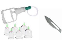 حجامة طبيعية بدون أدوية الطائف