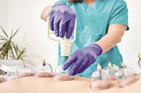 مركز حجامة موثوق في الطائف