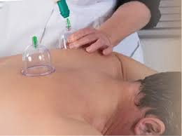 حجامة بدون آثار الطائف