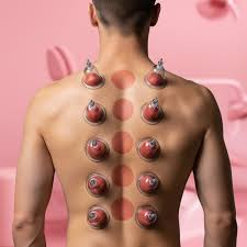 حجامة للتخلص من السموم الطائف