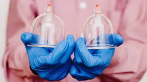 حجامة علاجية بجودة عالية الطائف