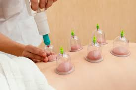 حجامة بالمعايير الصحية الطائف